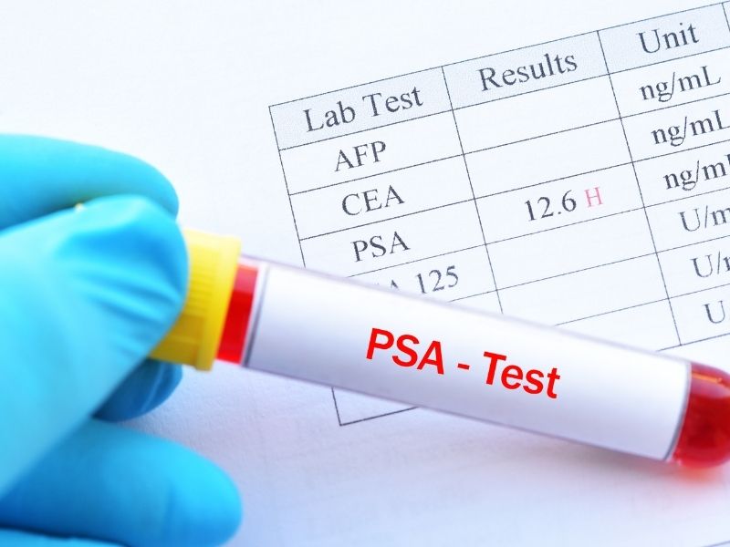 psa-degeriniz-yuksekse