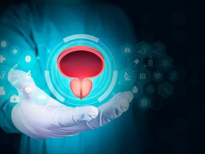 prostat-kanserinde-fuzyon-biyopsisi-kimlere-nasil-ne-zaman