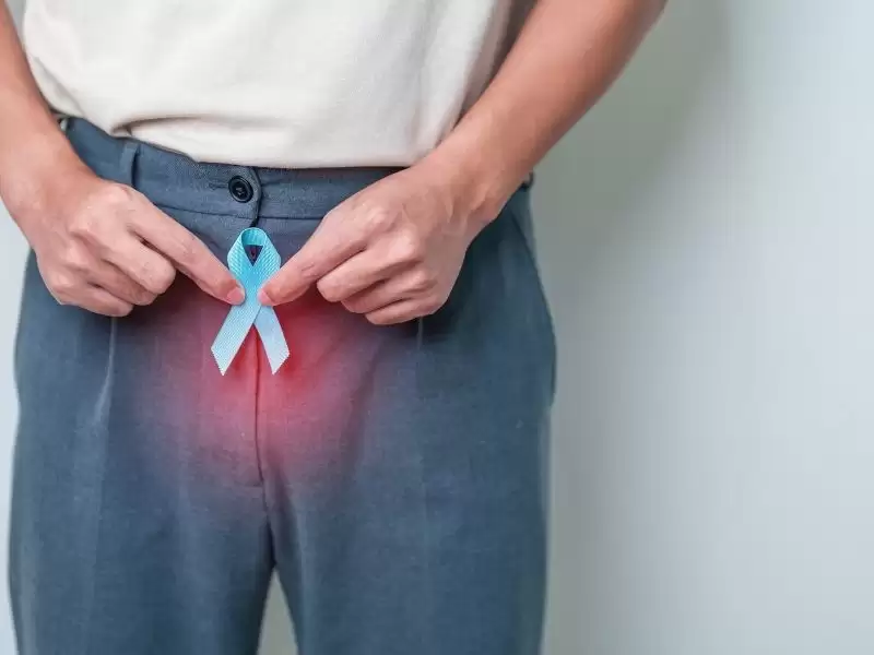 prostat-kanserinde-tedavi-yontemleri-cerrahi-radyoterapi-aktif-izlem-ve-fokal-opsiyonlar