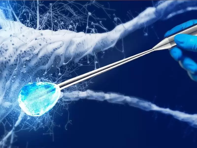 selektif-dorsal-sinir-krioablasyonu-erken-bosalma-tedavisi