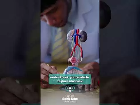 Böbrek taşları ameliyatsız tedavi edilebilir mi?