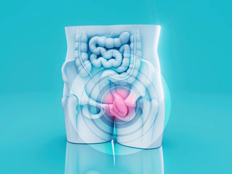 ankarada-prostat-kanseri-tani-ve-tedavisi