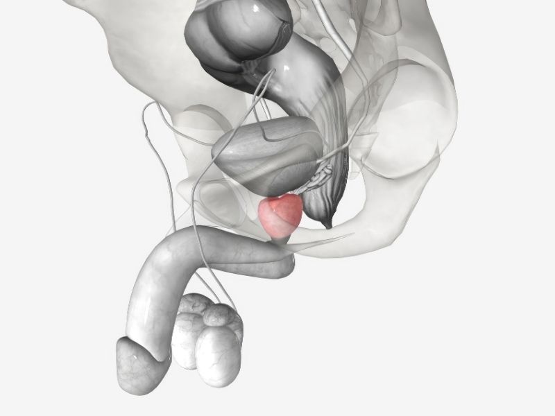 prostatin-buyuklugu-ile-sikayetler-arasinda-direkt-bir-iliski-var-midir