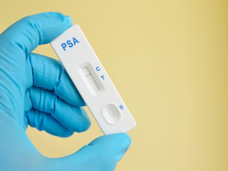 psa-yuksekliginde-hangi-testler-yapilir