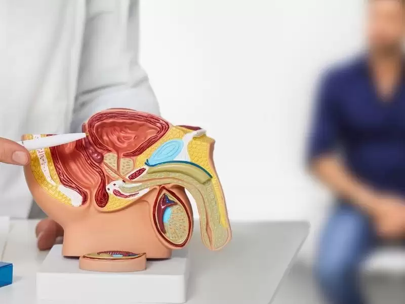 prostat-kanserinde-tedavi-yontemleri-cerrahi-radyoterapi-aktif-izlem-ve-fokal-opsiyonlar