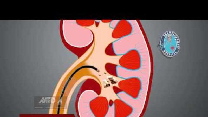 video,paylaşım,kameralı telefon,videofon,ücretsiz,yükleme