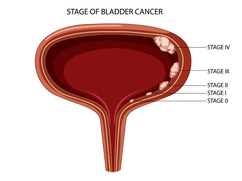 tur-m-ameliyati-nasil-yapilir