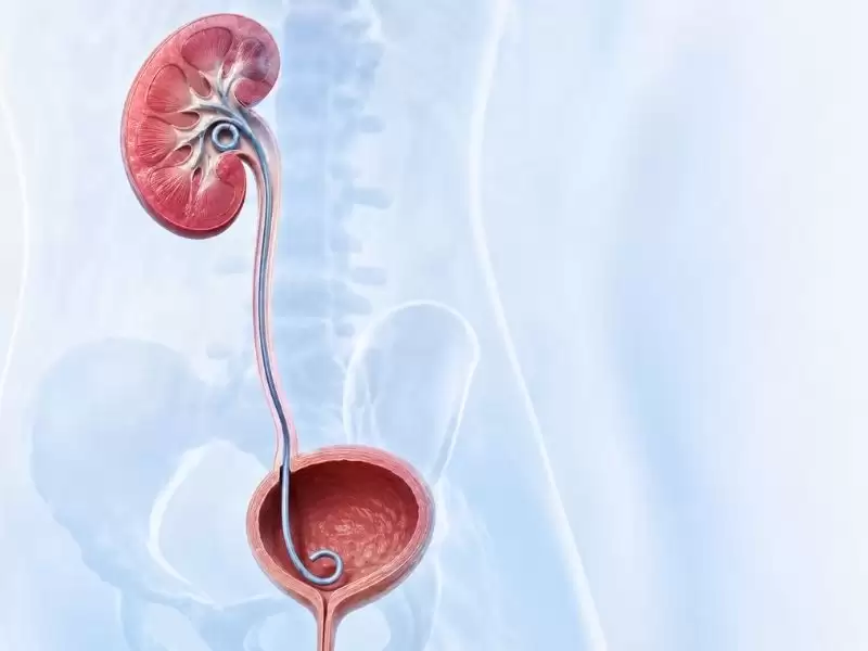 double-j-dj-stent-nedir-ameliyat-sonrasi-rehber