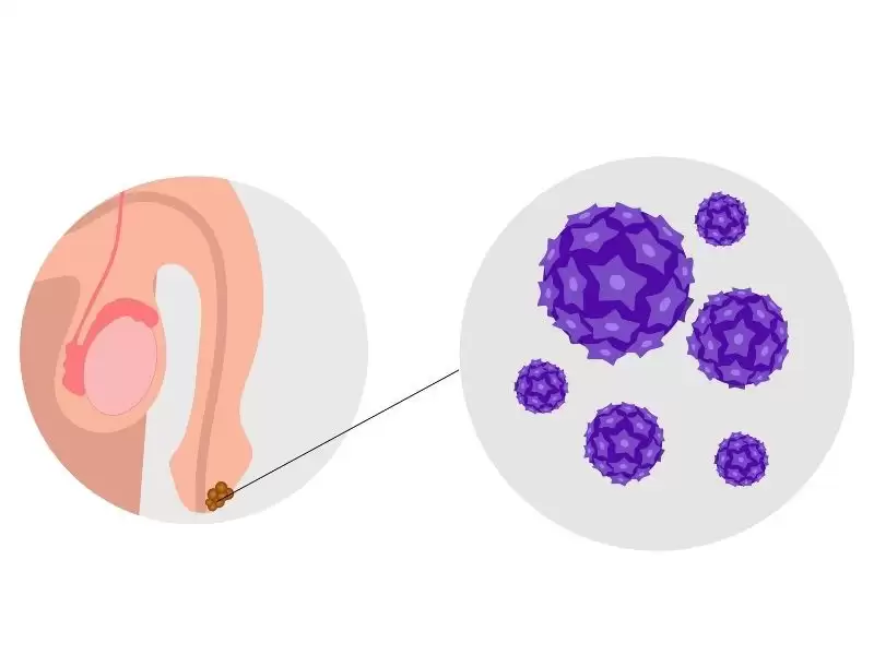 erkeklerde-hpv-nedir